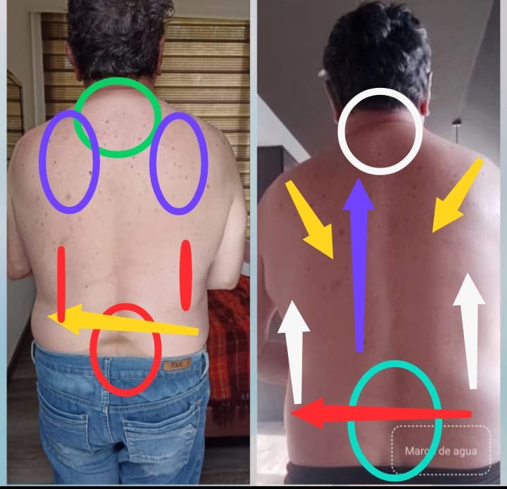 La foto de la izquierda fue el 22 de abril y la de la derecha el 2 de julio de 2024, 6 sesiones a distancia.